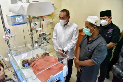 Jenguk Bayi Kembar Siam asal Asahan, Gubernur Edy Rahmayadi Jamin Biaya Perobatan si Kembar Ratih dan Ririn